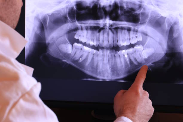 Best Knocked-Out Tooth Emergency  in Leisure Knoll, NJ